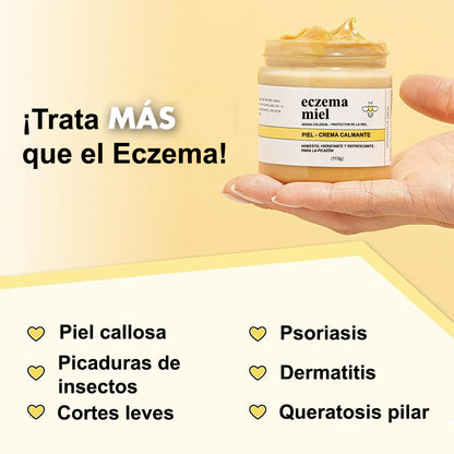 AUREORAN Eczema  | Crema calmante de miel para Eczema